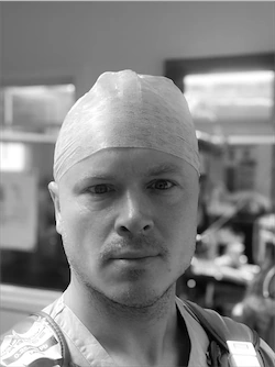 york hand surgeon